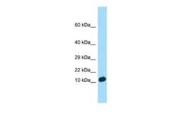 CCDC26 Rabbit anti-Human, Polyclonal, Novus Biologicals:Antibodies:Primary
